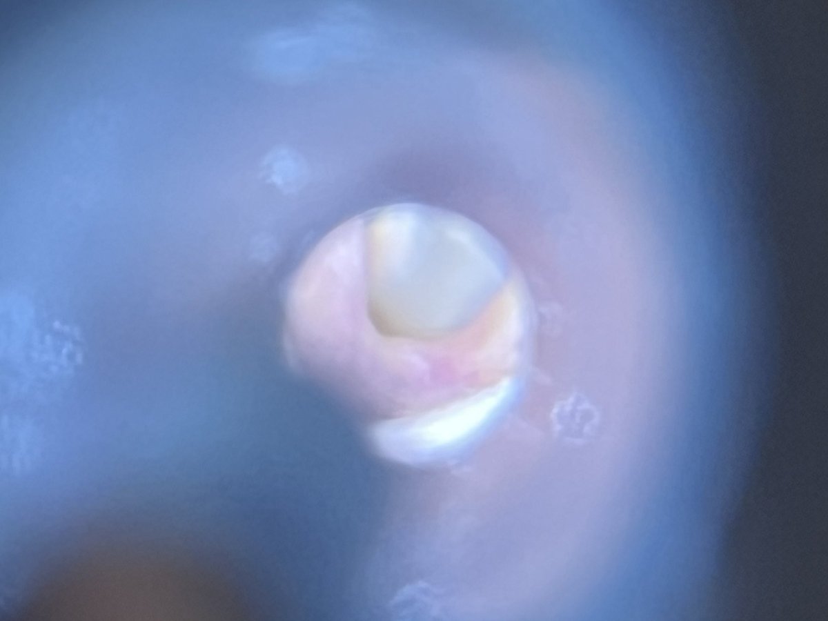 B, The Favorite Ex-GF ✨ tweet media