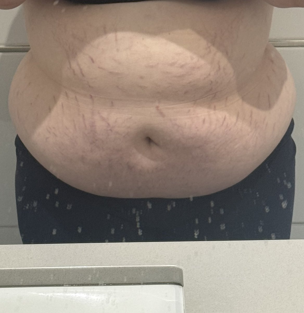 Senia | EDtwt tweet media