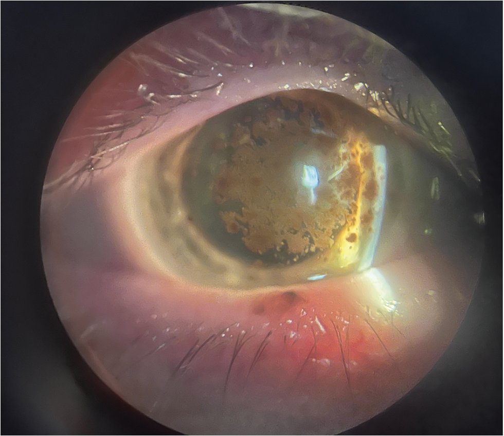 Review of Ophthalmology tweet media