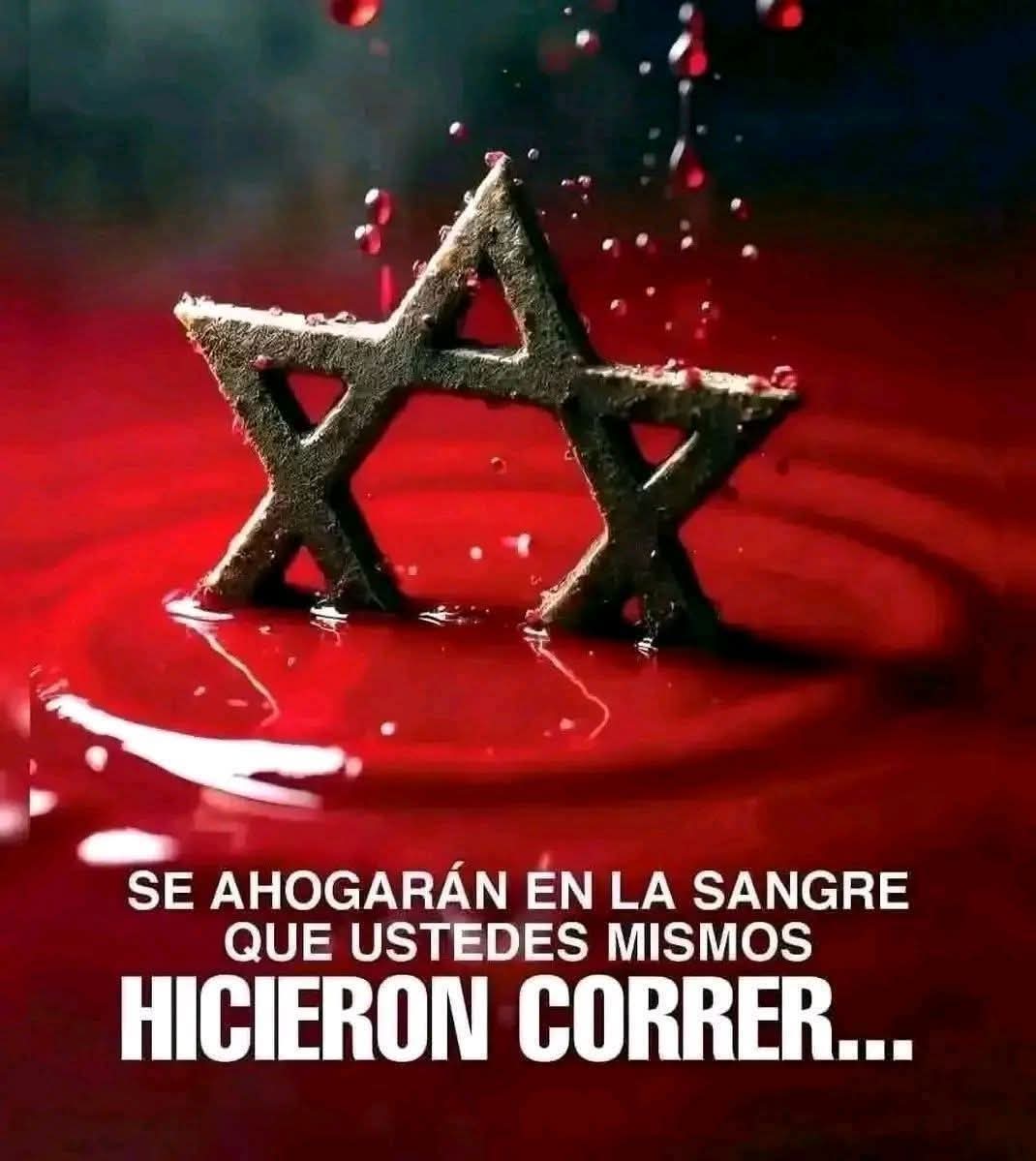 Lean🇦🇷🇵🇸🇷🇺✌️ tweet media