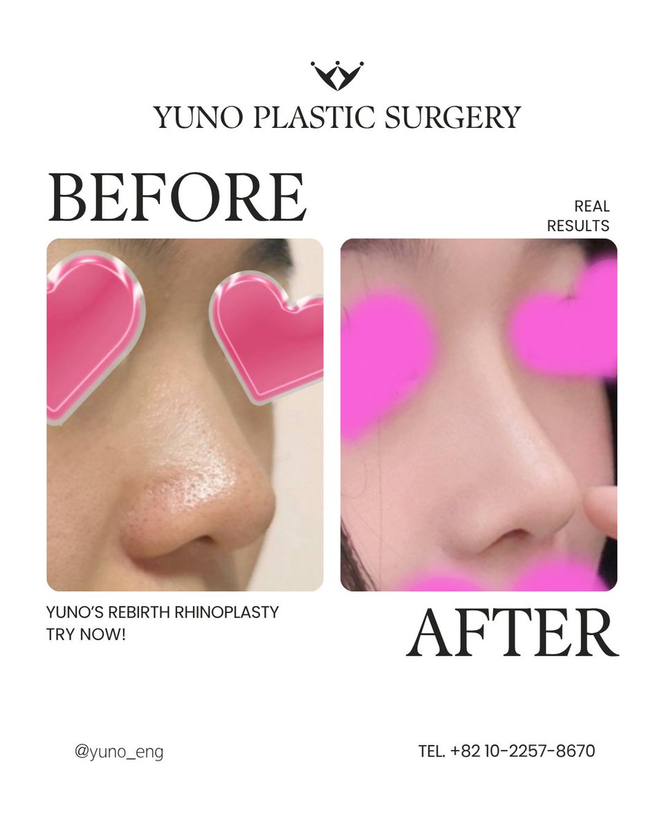 Yuno Plastic Surgery_ENG (@yuno_eng) / Posts / X