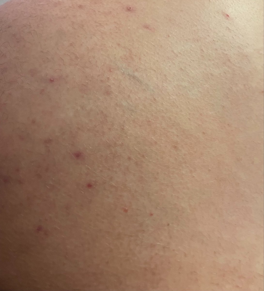 𝙼𝙰𝚃𝙷𝙴𝚄𝚂 tweet media