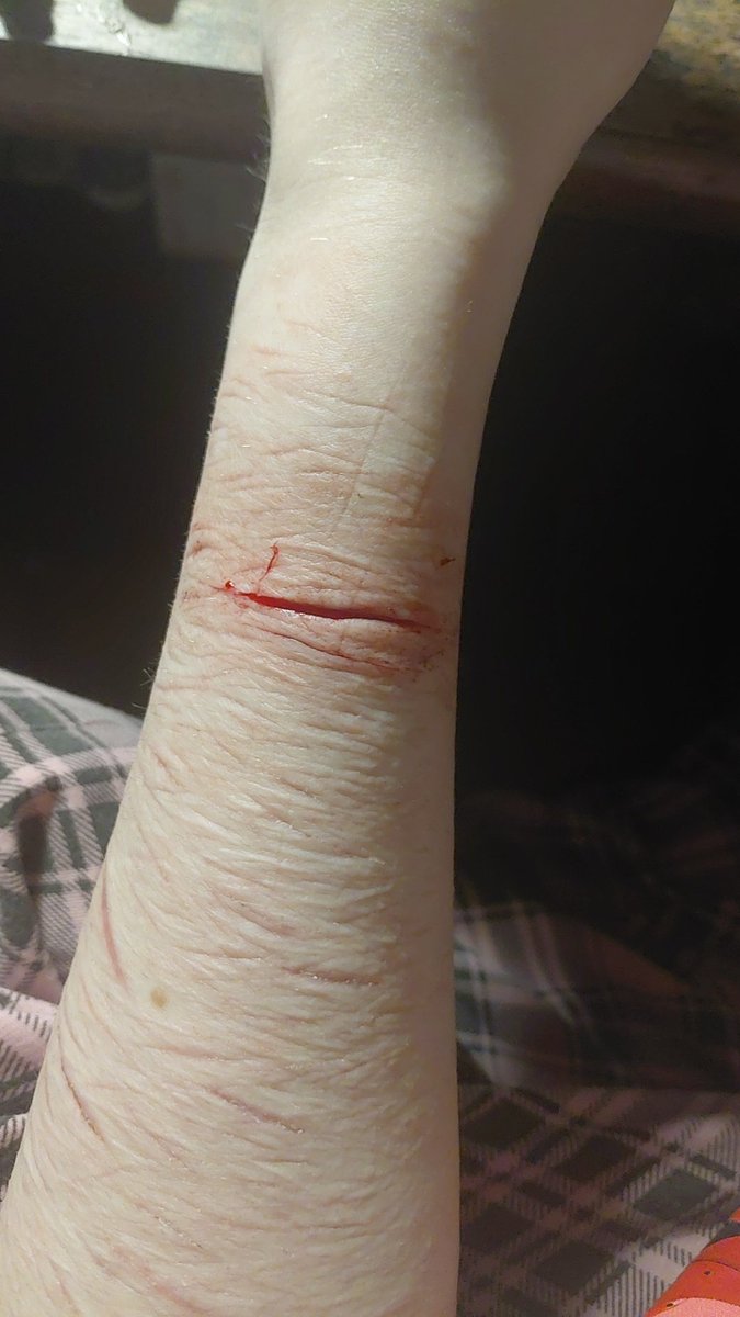 mamduzegochuja's tweet image. small multiswipe cuz i can't do more
#shtwt #shedtwt #988twt