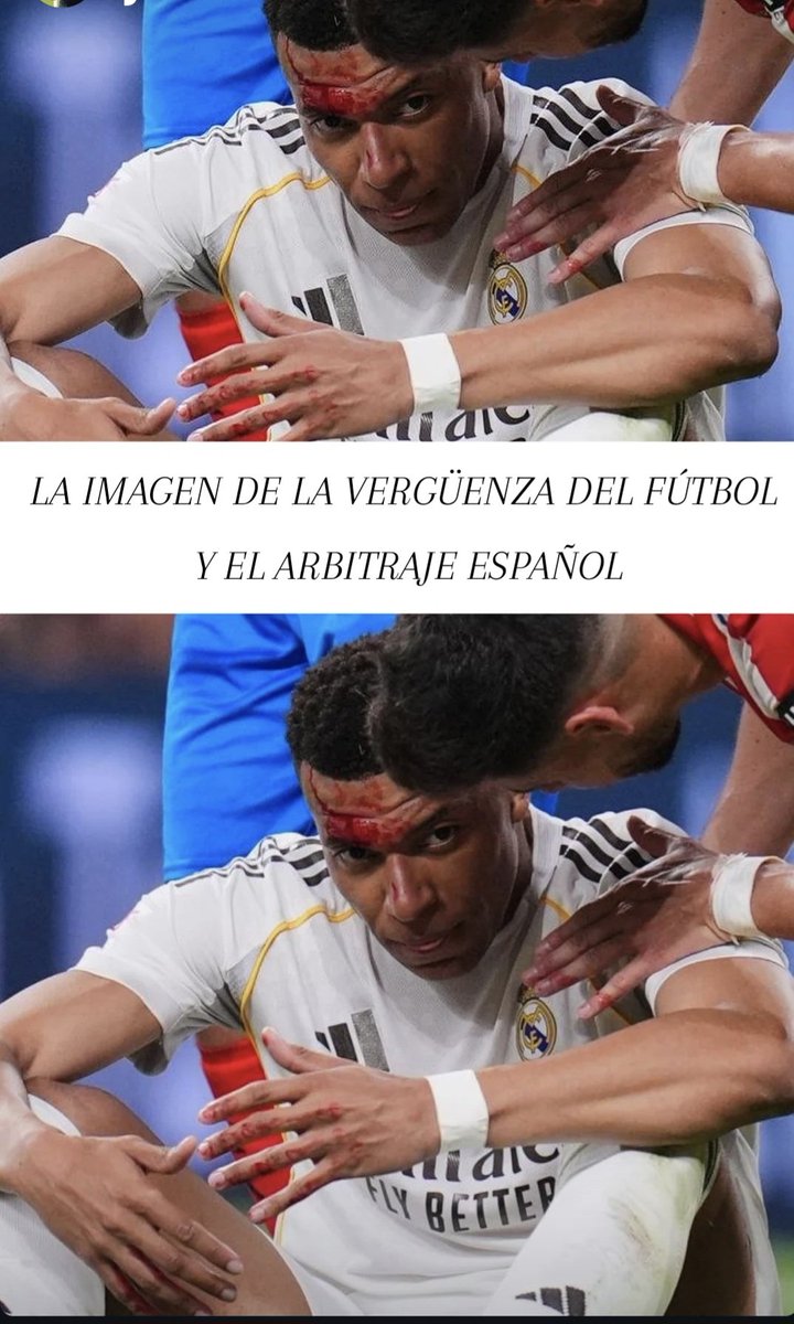 #RealMadridGirona
#LigaNegreira 
<a href="/CTARFEF/">CTA</a>
<a href="/rfef/">RFEF</a>
<a href="/LaLiga/">LALIGA</a>
BANDA DE SINVERGÜENZAS Y CORRUPTOS. 
DAIS ASCO!! 😡