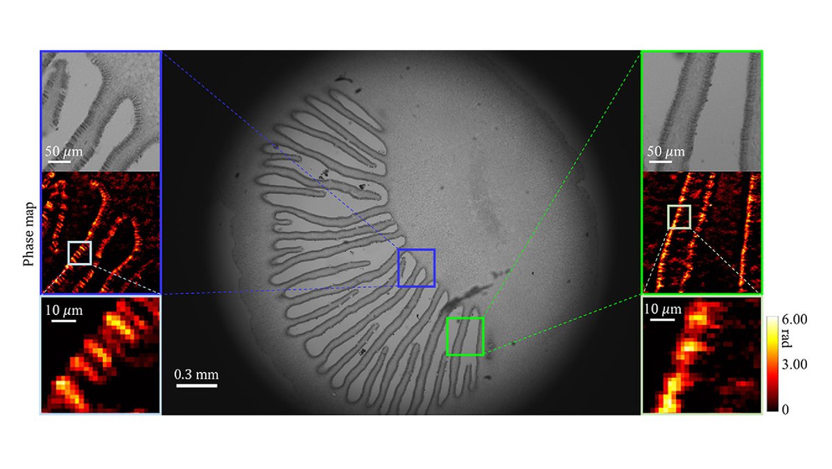 OpticaPubsGroup's tweet photo. An Editors' Pick via #OPG_BOEx: Towards a mobile quantitative phase imaging microscope with smartphone phase-detection sensors https://t.co/yM0Ou4LDI7 #PhaseGradientImaging #ComputationalMicroscopy @DukeU https://t.co/pVE39EnrNg