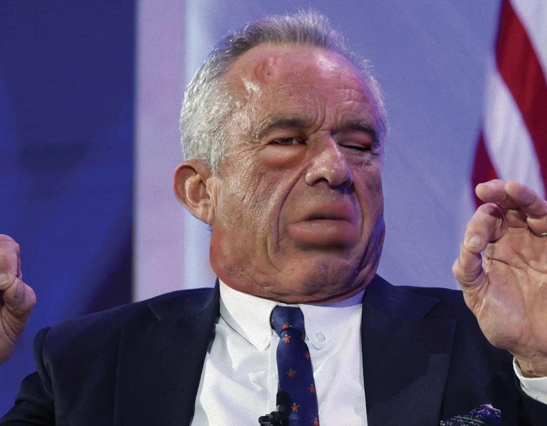 chiky handler tweet media