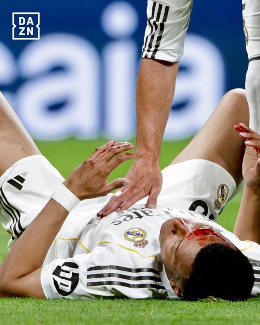 Team Mbappe tweet media