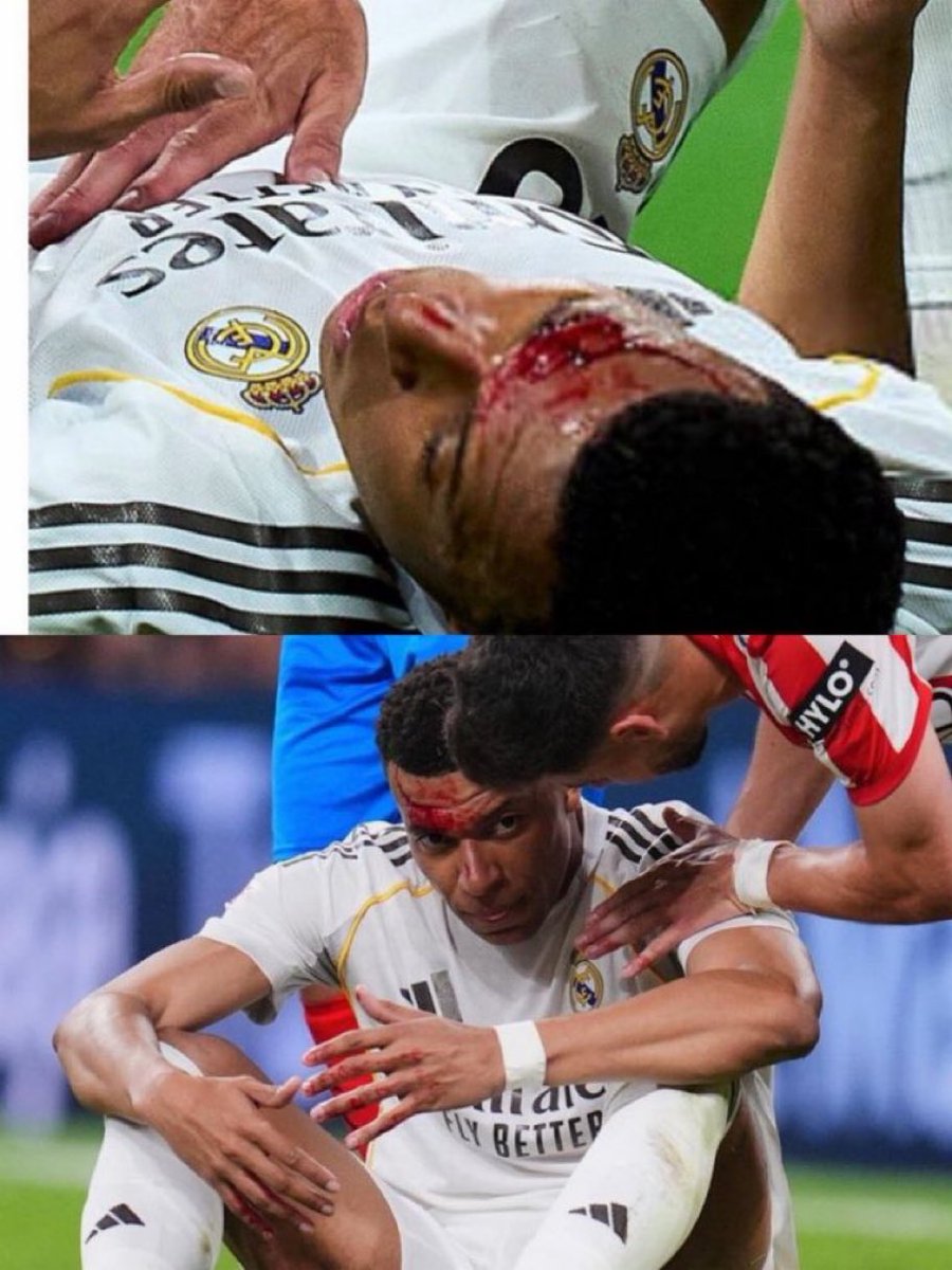 OndaVital🇪🇸 tweet media