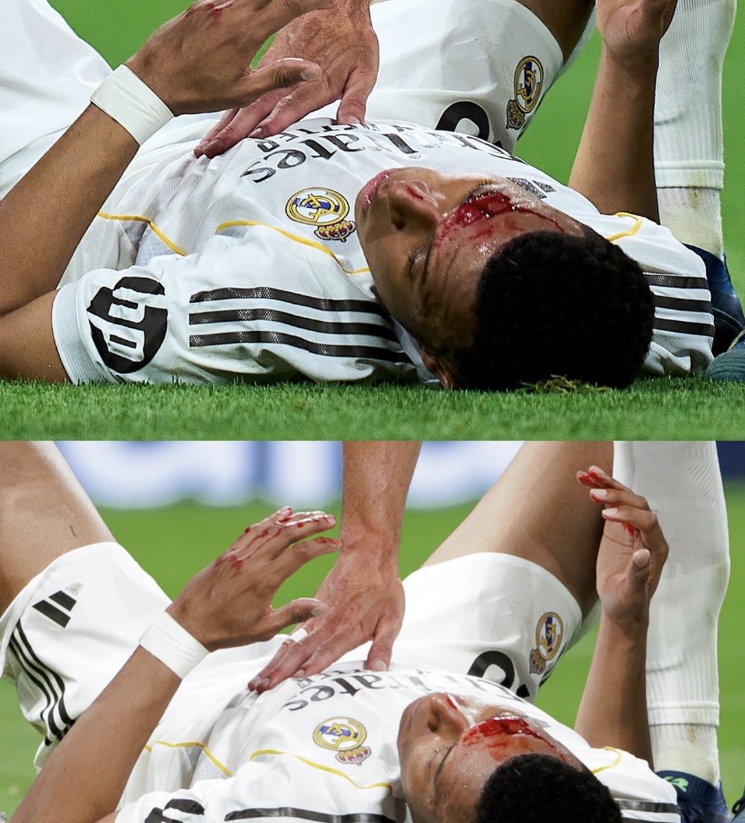 El Güero tweet media