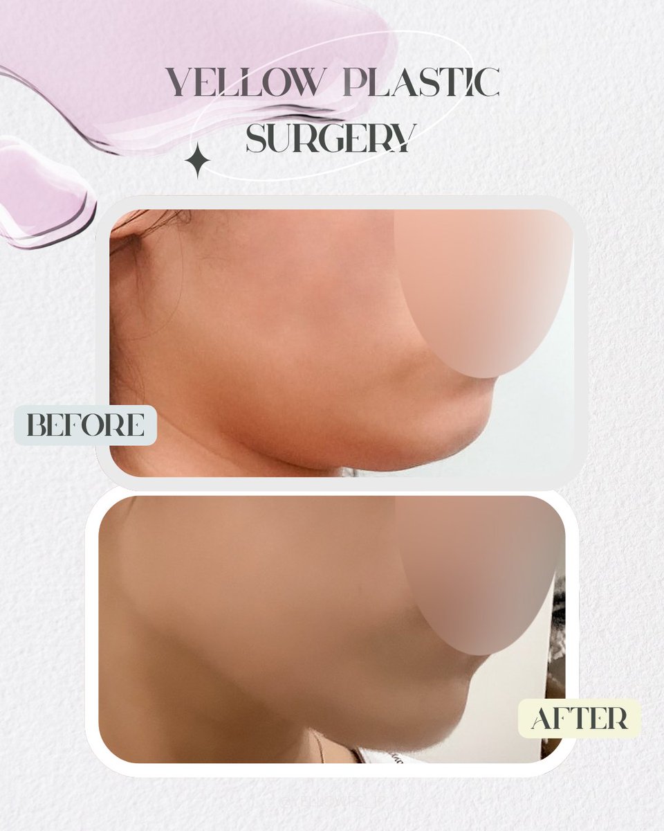 💛イエロー美容整形外科(公式)💛 tweet media