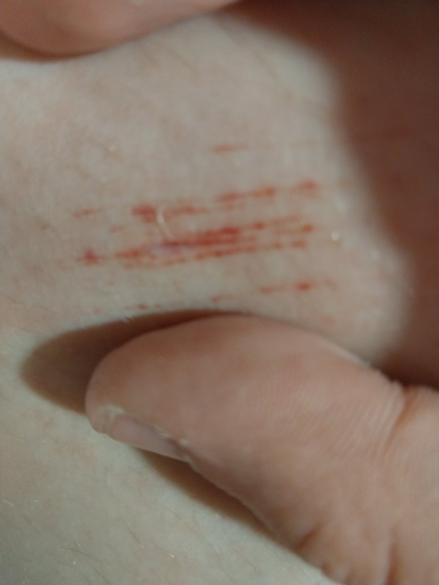 💫 megumii 🐾 tweet media