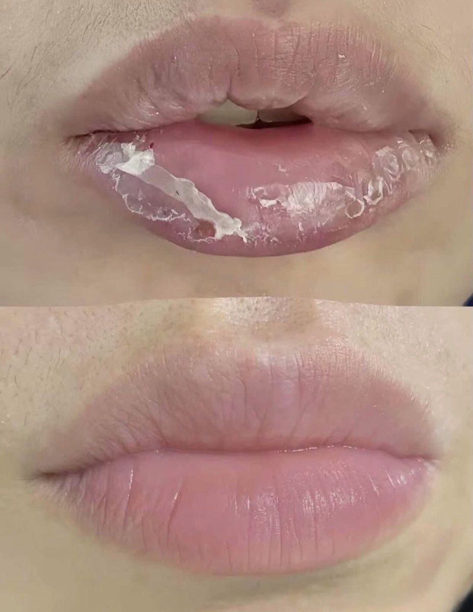 ilonaraa tweet media