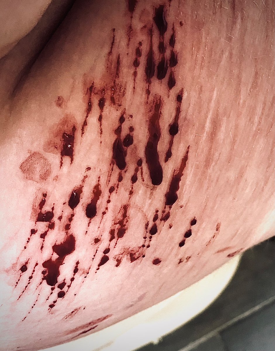 losingaffextion's tweet photo. all fake sfx

styro sesh #shtwt #slittwt #fakesfx https://t.co/3J91MtR6fw