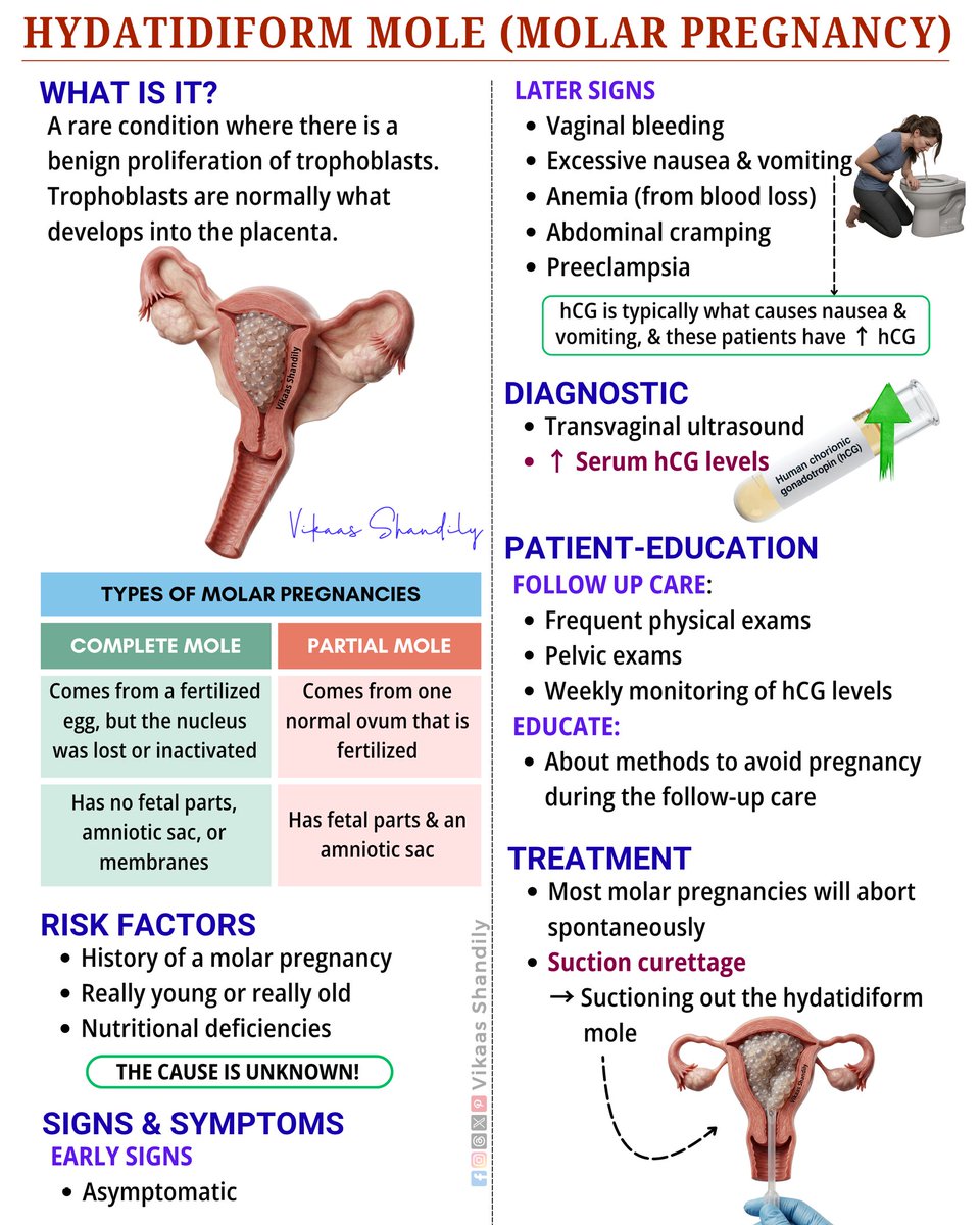 VikaasShandily's tweet image. Hydatidiform Mole (Molar Pregnancy) 
#MolarPregnancy #OBGYN #hCG #MedicalEducation #VikaasShandily