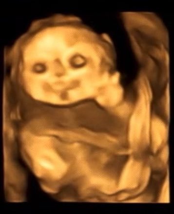 はむ@ソン🐷🐮 tweet media