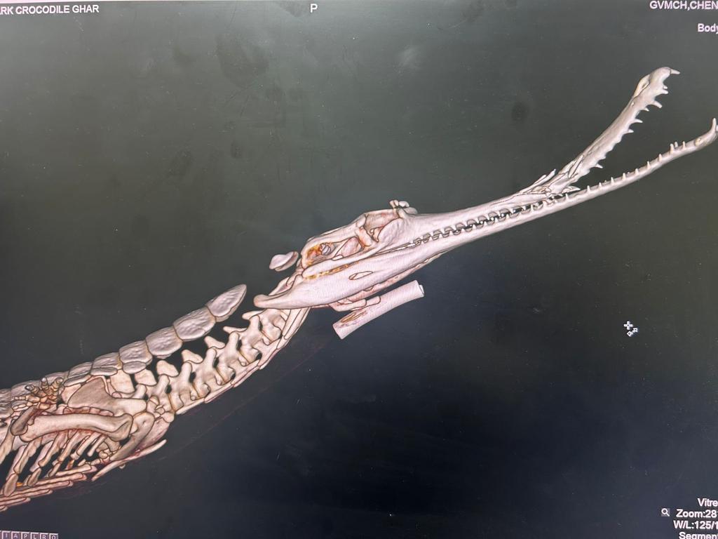 Kudos to Dr.Shafi and team of MVC for correcting a fracture of upper jaw of a gharial, caused by infighting. The team evaluated the injury after a radiographic and CT analysis and used super cutaneous plating technique. The animal recovered uneventfully.