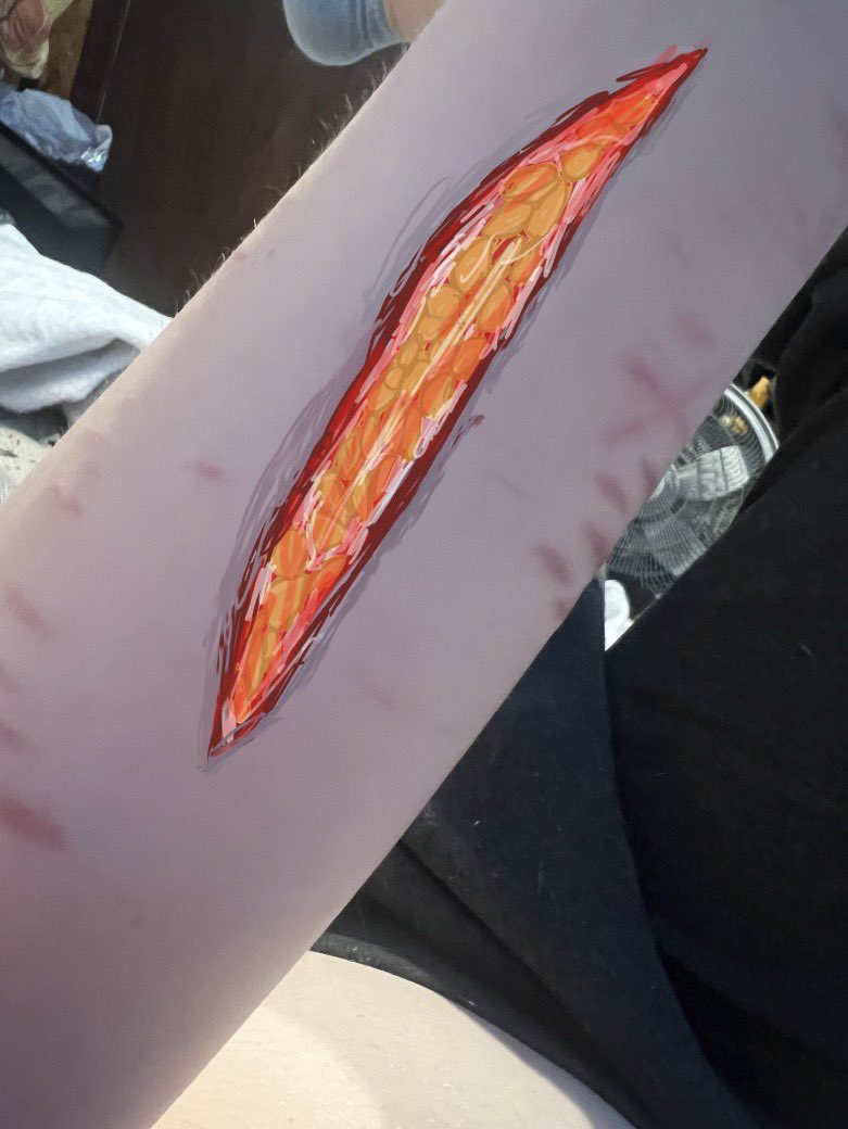 Josie03964191's tweet image. I drew the kind of cut I want to get before I fully stop self harm (don’t mind my shitty drawing I’m not good at art) #shtwt #shedtwt #slittwt #selfharm #selfharmtwt #cutspo #scarspo