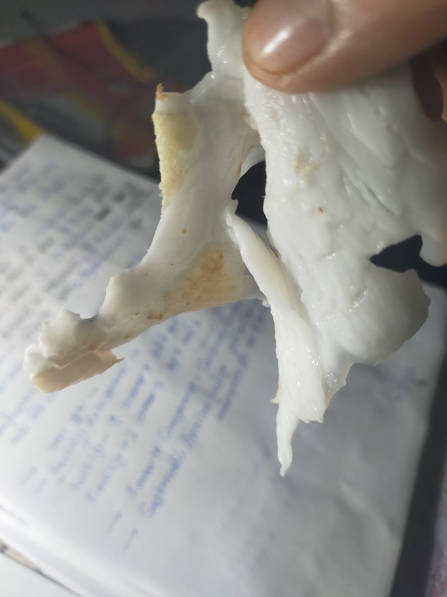 gambhirsin24472's tweet image. ❓ क्या आप पहचान सकते हैं यह क्या है?
इस तस्वीर को ध्यान से देखिए 👇

यह क्या है?
A. Non-veg 
B. Veg 
C. फल
D. प्रोसेस्ड फूड

जो सही जवाब नहीं बता पाएगा… उसे यह खाना पड़ेगा 😄
💬 अपना जवाब कमेंट में दें — देखते हैं असली पहचान किसे है! 
#Challenge #FoodQuiz