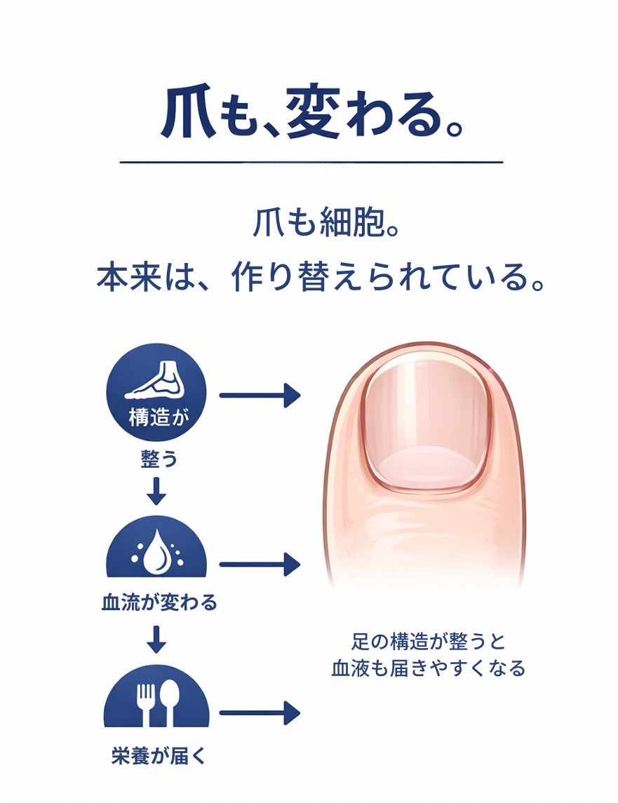 IshokudougenLab's tweet photo. 足の再生は、 捻挫癖や外反母趾を整えるだけじゃない。

爪も細胞。 本来、作り替えられている。

でも ・伸びにくい ・治療後も変わらない

→治療で爪に「菌」がいなくなっても変わらないなら “代謝が止まっている”サインかもしれない。

構造が整うと、血流が変わる。 →栄��が届く
すると → 爪まで変わる

これは自然なことです。

足の再生は50歳からでも可能✨