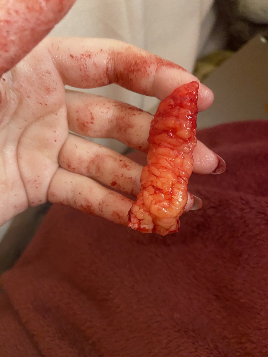 PICKLE🐺🙉 im trying to follow everyone back😿😿 tweet media