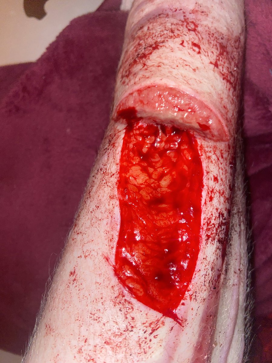 PICKLE🐺🙉 im trying to follow everyone back😿😿 tweet media