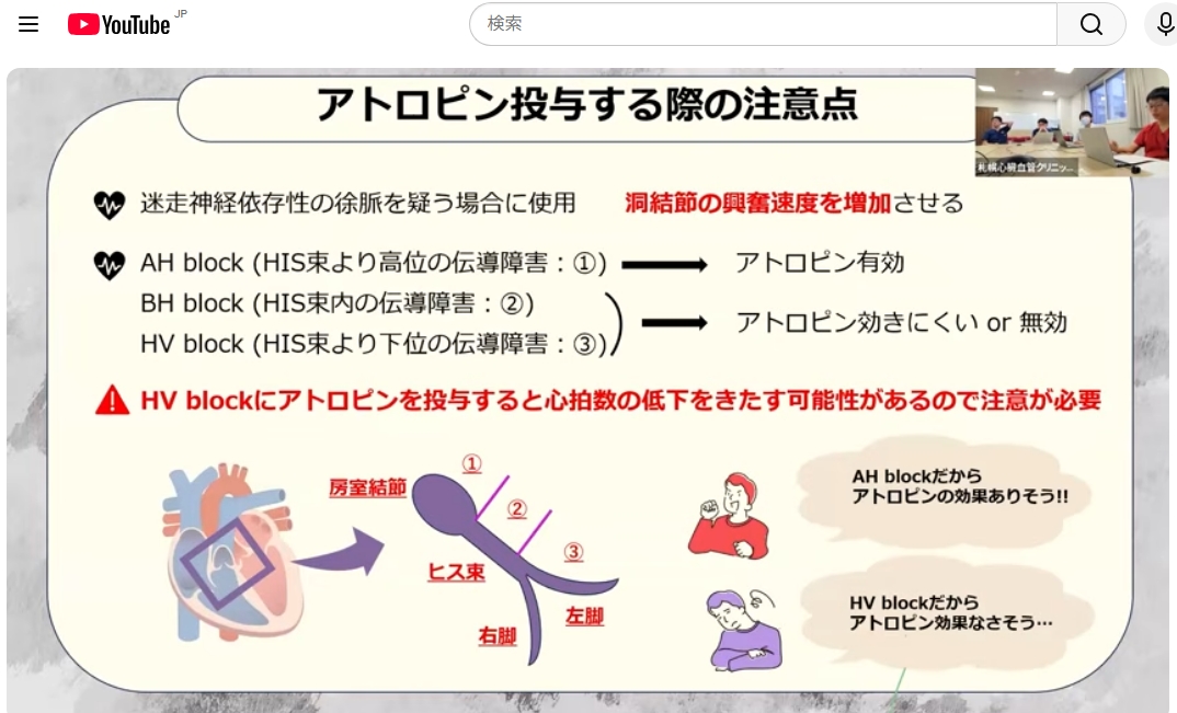 XkeiT5stoD53218's tweet photo. 「You tube #エコー室勉強会番外編」より
アトロピンは徐脈全てに有効ではないので注意 https://t.co/E4X9ZjGPC2