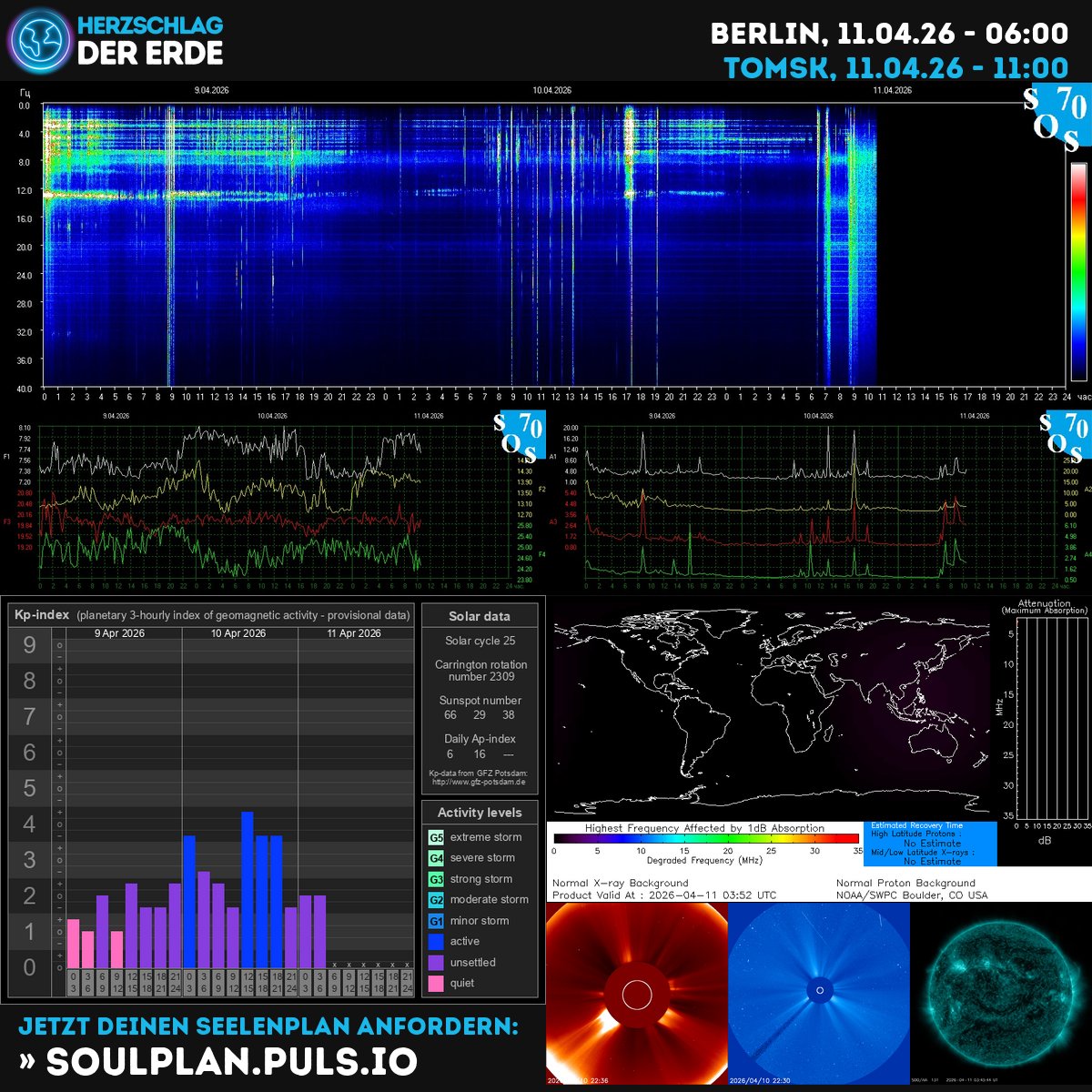 SchumannBotDE's tweet photo. 🌍✨ The Earth's heartbeat pulses with cosmic energy today! Solar winds dance as the Kp-index rises—feel the shift, trust the flow, and align with the Universe's rhythm. 💫 https://t.co/lNVeS1uSHa #Schumann #SolarWind #CosmicAlignment https://t.co/s2SNYStg3o