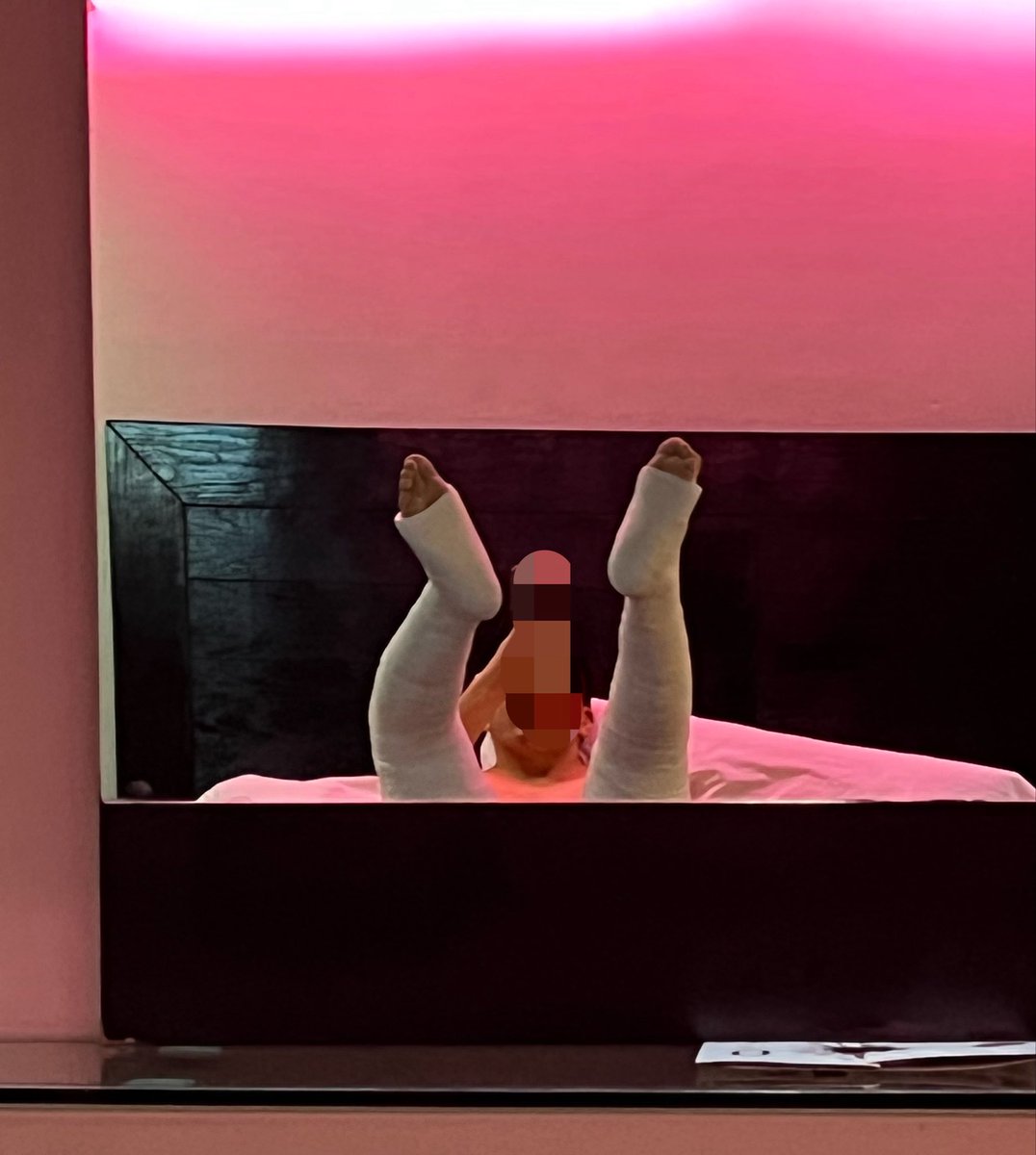 evercast121's tweet photo. A memory from my adventure a while ago!
#dllc #legcast #castfetish #plaster #casterboy #diaper #dl #patient #medicalfetish https://t.co/pnXtXWreXt