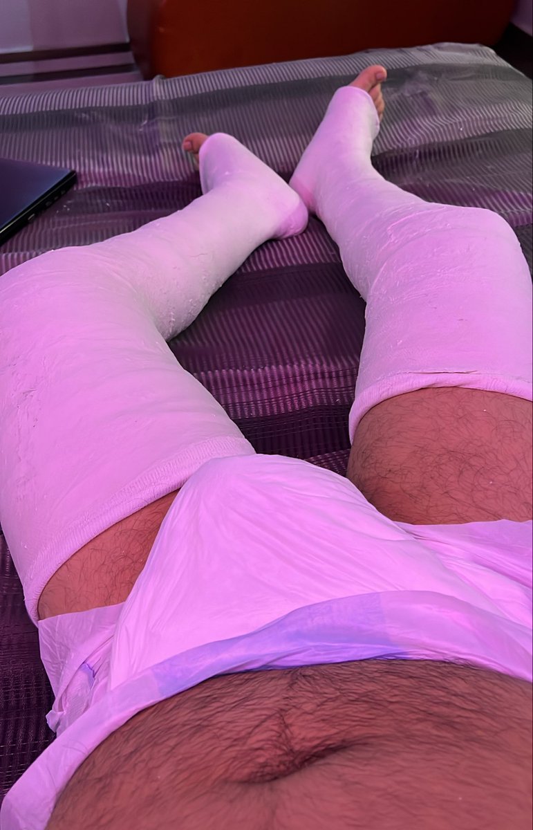 evercast121's tweet photo. A memory from my adventure a while ago!
#dllc #legcast #castfetish #plaster #casterboy #diaper #dl #patient #medicalfetish https://t.co/pnXtXWreXt