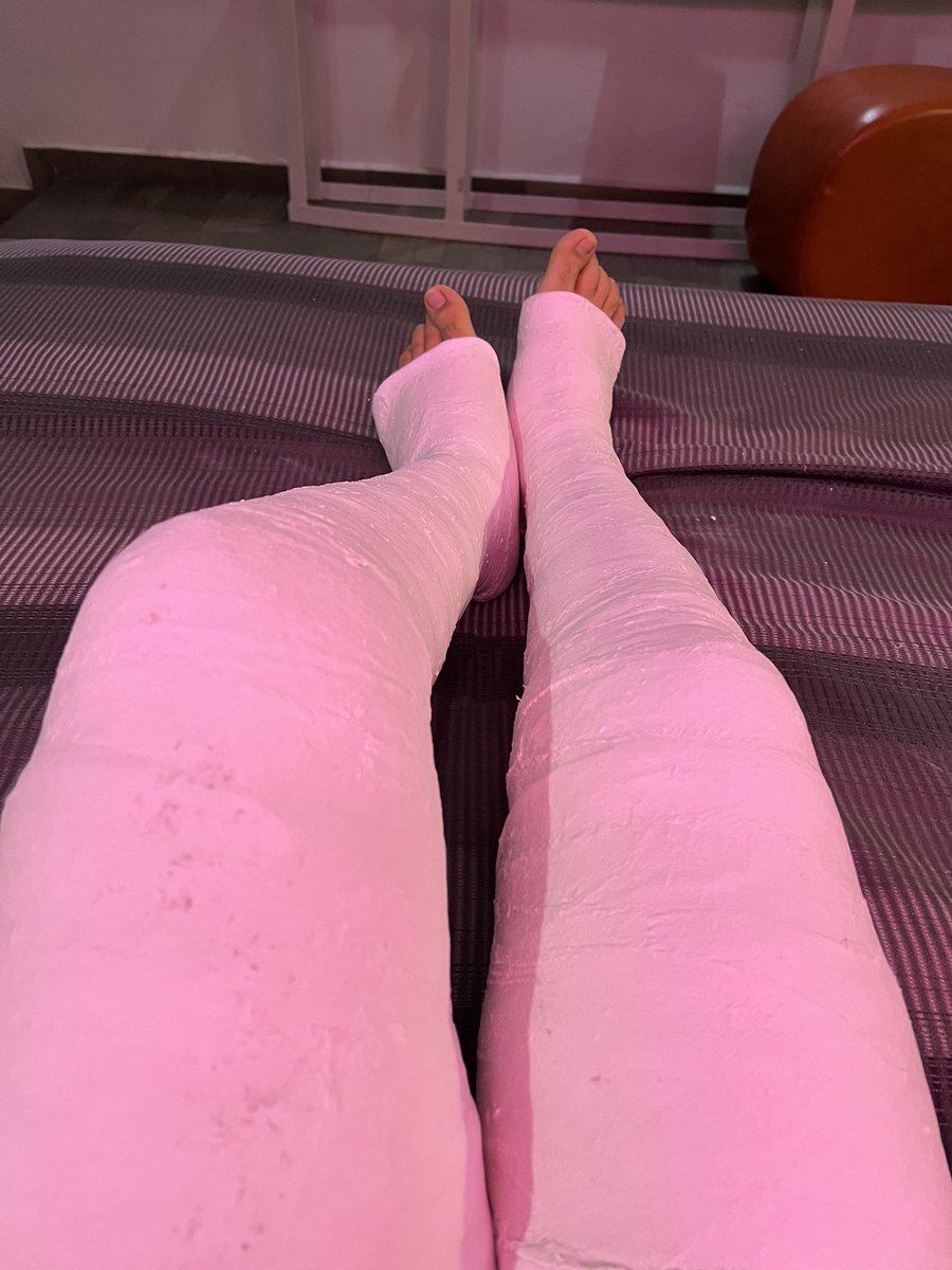 evercast121's tweet photo. A memory from my adventure a while ago!
#dllc #legcast #castfetish #plaster #casterboy #diaper #dl #patient #medicalfetish https://t.co/pnXtXWreXt