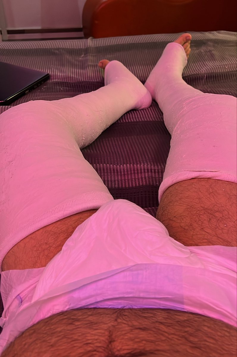 evercast121's tweet photo. A memory from my adventure a while ago!
#dllc #legcast #castfetish #plaster #casterboy #diaper #dl #patient #medicalfetish https://t.co/pnXtXWreXt