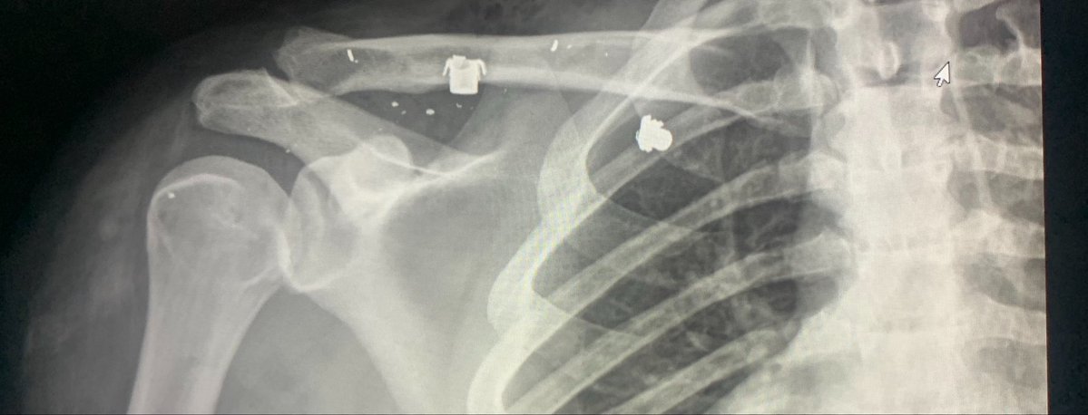 Atl Daddy 💪🏿👑 tweet media