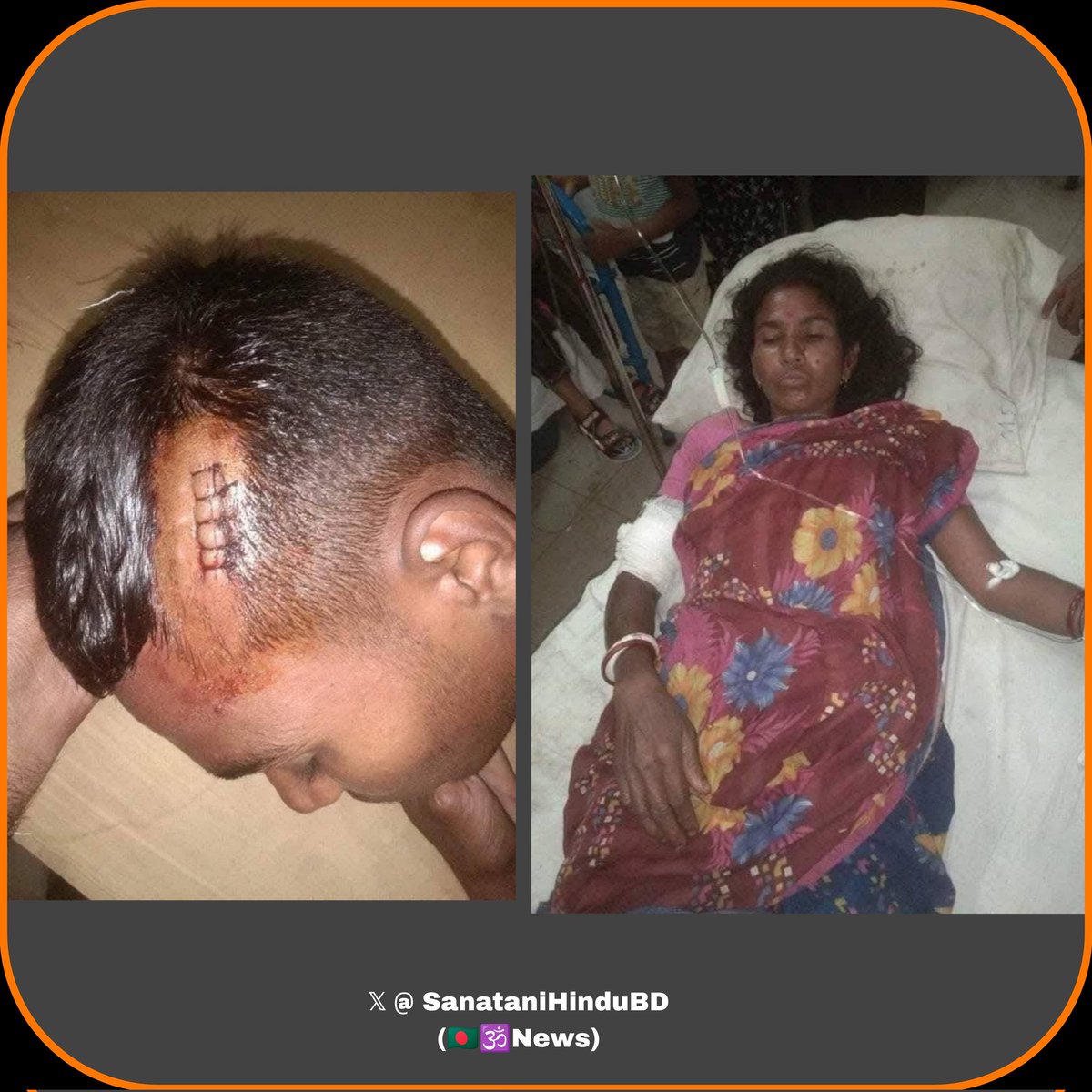 Bangladesh 🇧🇩 : Hindu family tortured by Mainul , Nurul, Rashid .
They also occupied the Hindu families land . 
Location 📍 Utrahajirpur,Raiganj,Sirajganj,Rajshahi.
