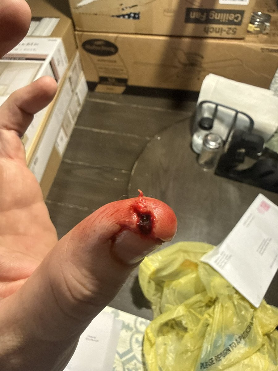 ChrisGoss0's tweet photo. @wifepepefrog Same cut my fingertip off today now this bs https://t.co/Keaw3UOSON