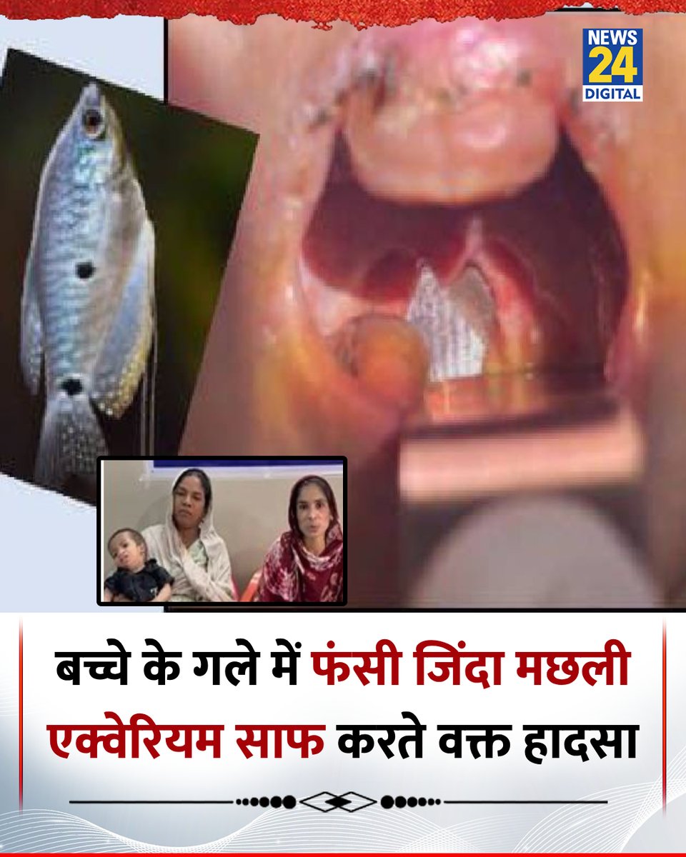 news24tvchannel's tweet image. मध्यप्रदेश: 1 साल के बच्चे के गले में फंसी जिंदा मछली

◆ एक्वेरियम साफ करते समय खेल-खेल में उछलकर बच्चे के मुंह में पहुंची

◆ डॉक्टरों ने ऑपरेशन कर गले से बाहर निकाली 3 इंच लंबी मछली

#MPNews | #Fish | #Indore | #Kid | #Viral