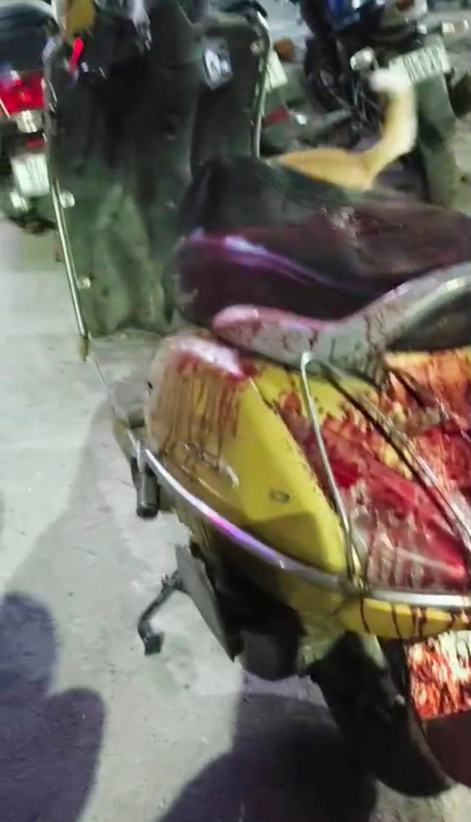 kunalkashyap_st's tweet image. #Delhi #WATCH मयूर विहार के त्रिलोकपुरी में कल रात हुजाफ (26) पर हुए कातिलाने हमले का खुलासा हो गया है। आरोपियों ने 2020 में हुए अपने परिजन की हत्या का का बदला लेने के लिए वारदात को अंजाम दिया था। हुजाफ के पिता पर वो हत्या करने का आरोप था। हालांकि इस बीच उनकी मौत हो गई थी। मगर