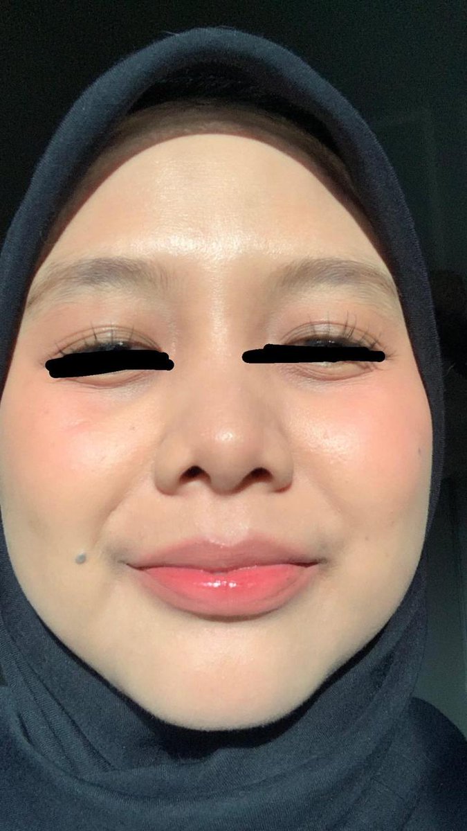 olala 🍑 tweet media