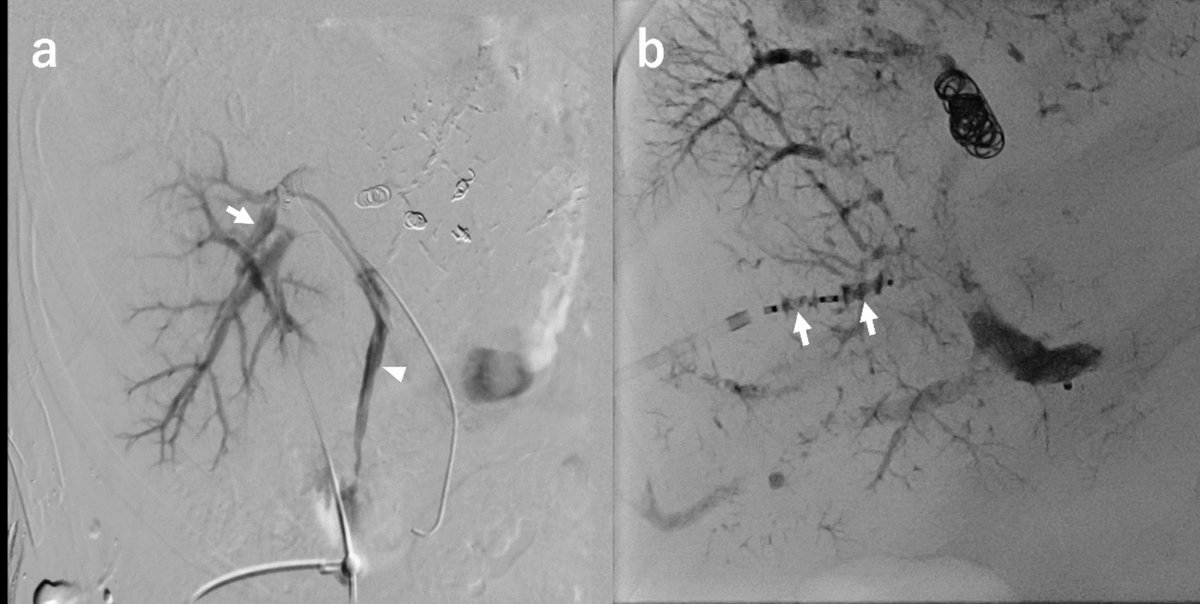 CIRSE European Trainee Forum tweet media