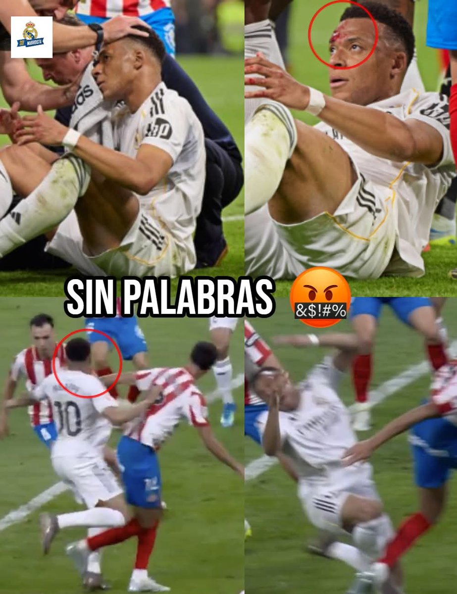 BlancaRedondoCa's tweet image. Nada más que decir, Mbappé terminó sangrando y ni el árbitro ni el VAR dijeron nada. 🤬
Un PENALTI como una casa.

No es fútbol, es Negreira. 🤮

#realmadrid  #LaLiga #HalaMadrid