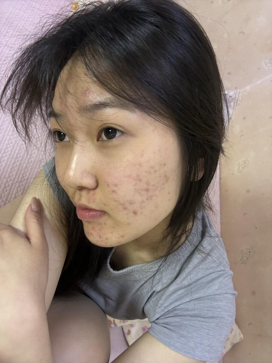 草莓蛋糕 tweet media