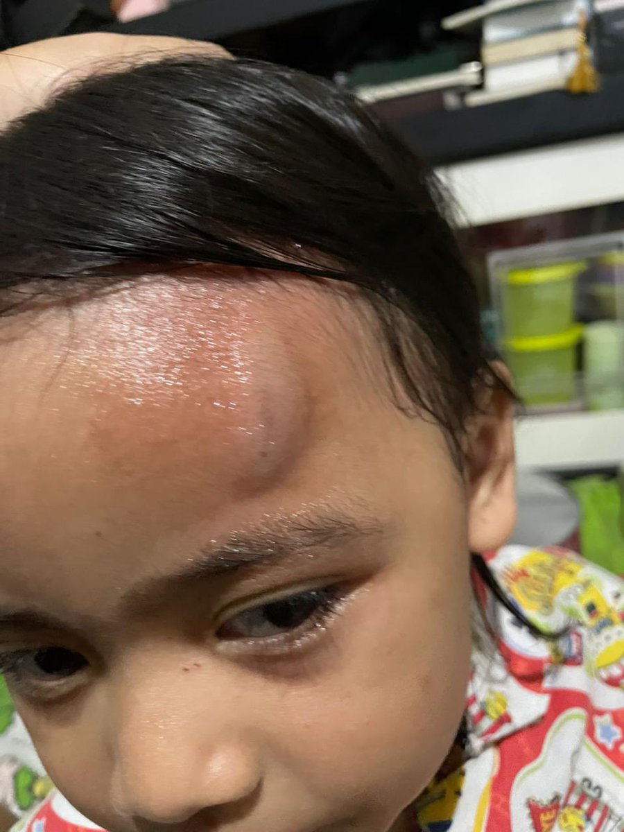 Malam minggu ini, si toddler ada aja gebrakan nya😌🤯