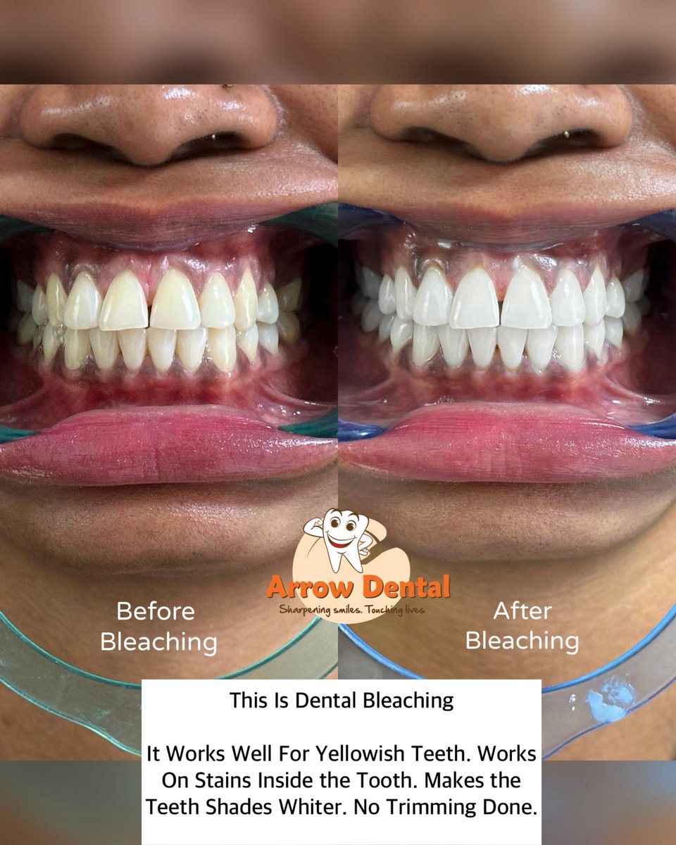 Arrow Dental Centre tweet media