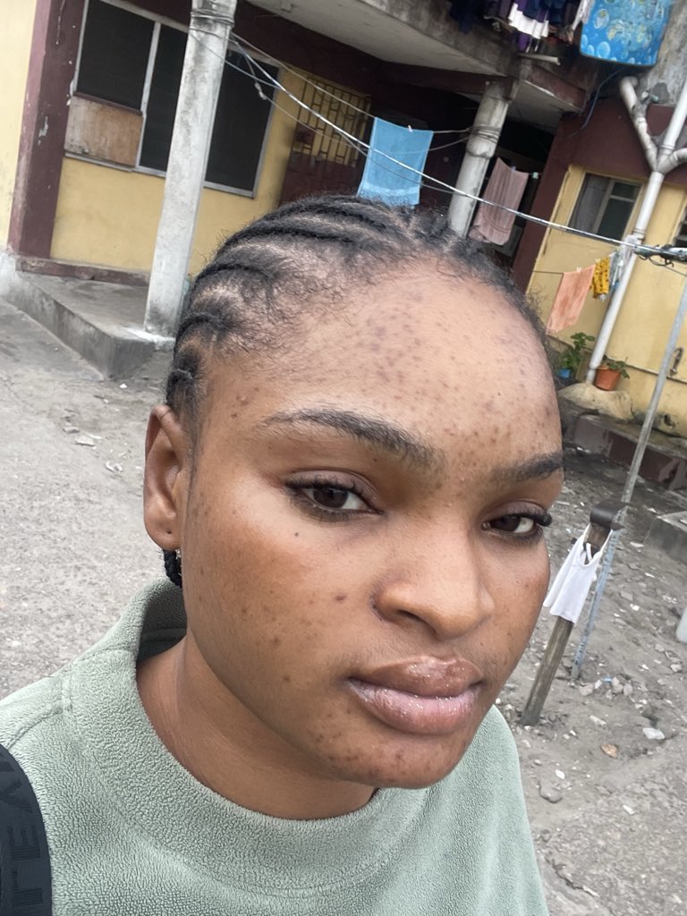 Enori🎀 tweet media