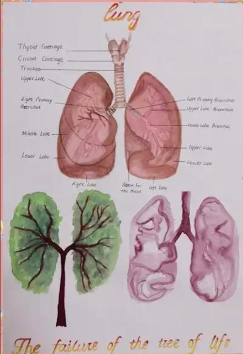 anatomyspecimen's tweet photo. Amazing lung structure https://t.co/y568bRXWtt