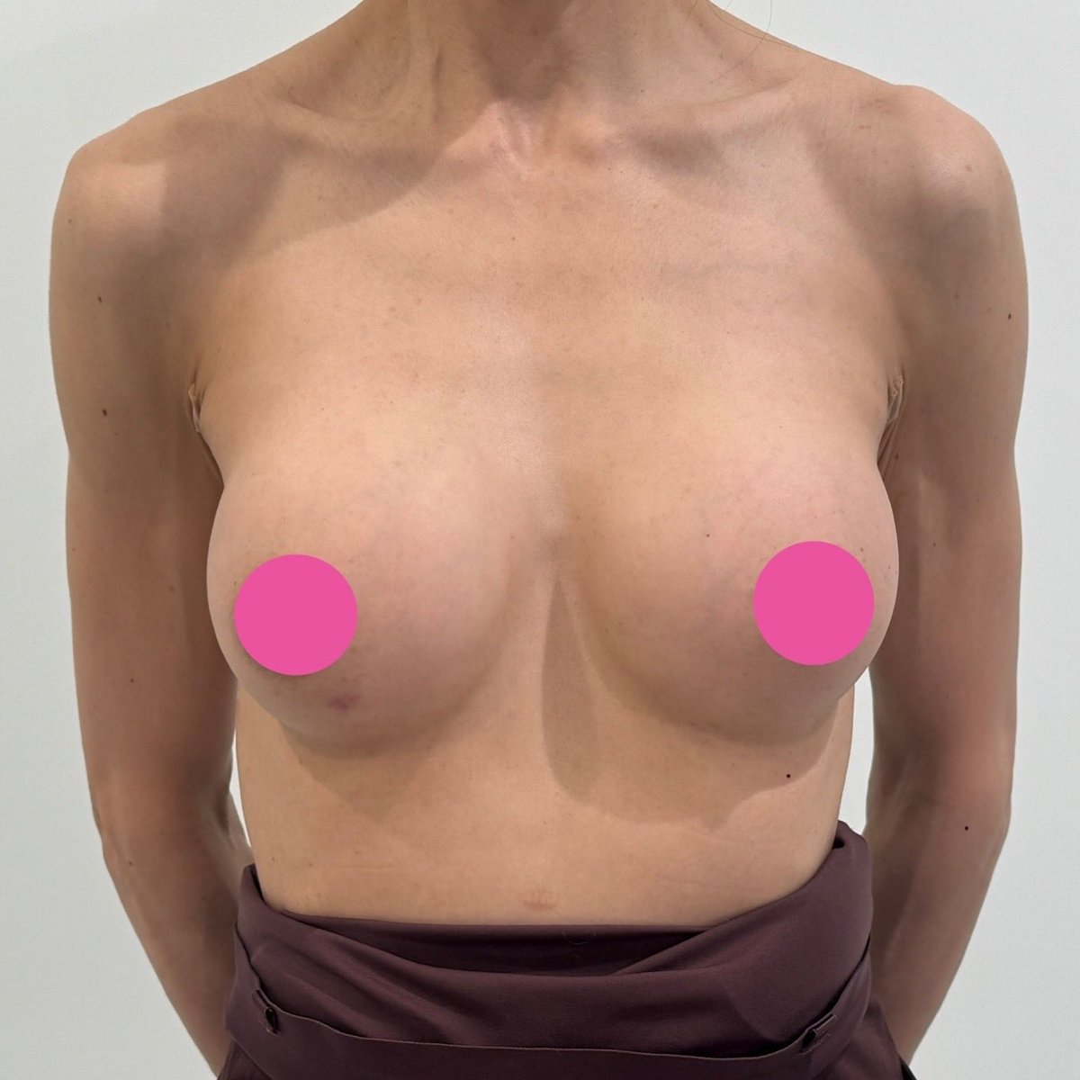 ベク(白)先生 形成外科専門医 tweet media