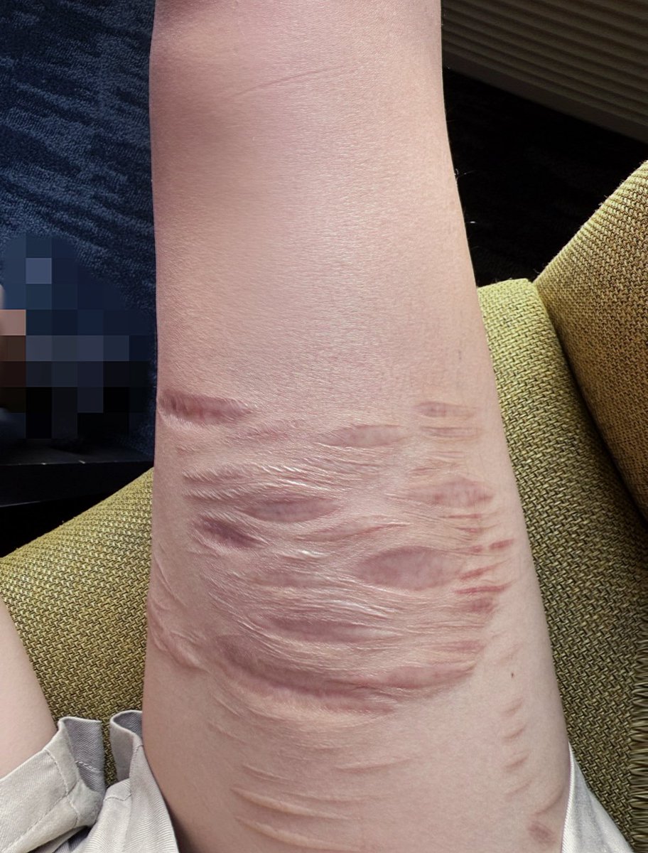 红豆糕🍰 tweet media