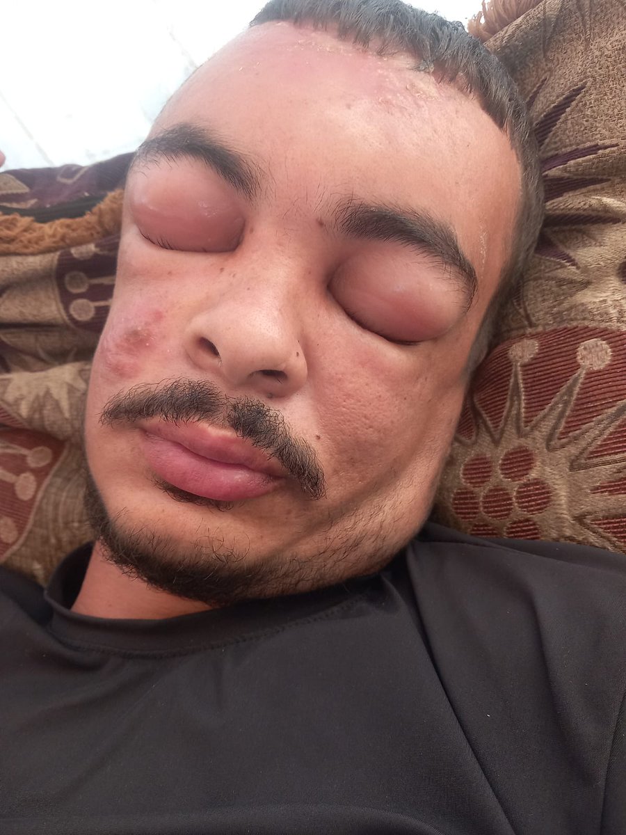 Ahmad in Gaza 🇵🇸✌️ tweet media