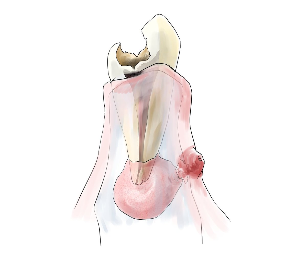 とおる（画伯歯医者）@口八丁手八丁 tweet media