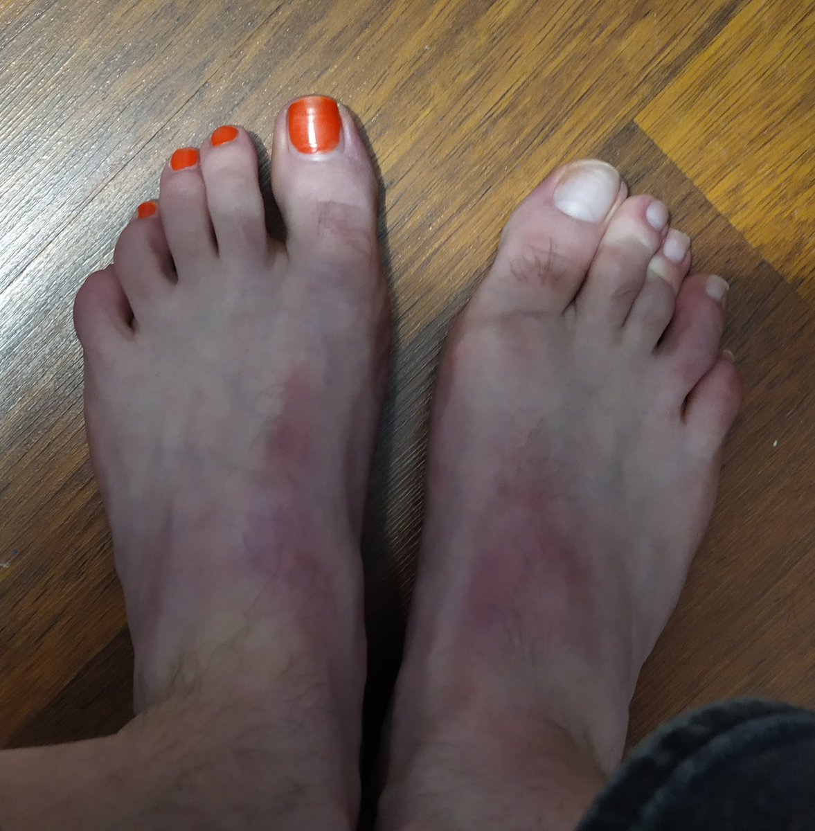 Boy Feet With Nail Polish 💅🏻 tweet media