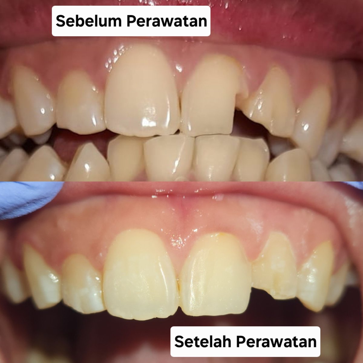 kayin | koas gigi jogja tweet media